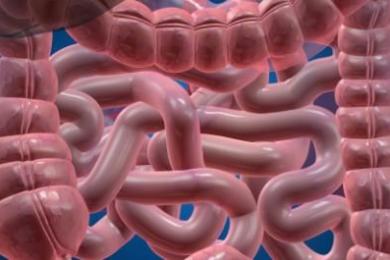 Bağırsak Hastalıkları