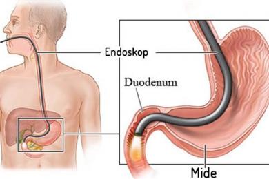 Endoskopik İşlemler